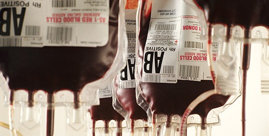 Nhóm máu AB có nguy cơ gặp các bất ổn về trí nhớ cao gấp đôi người mang nhóm máu O