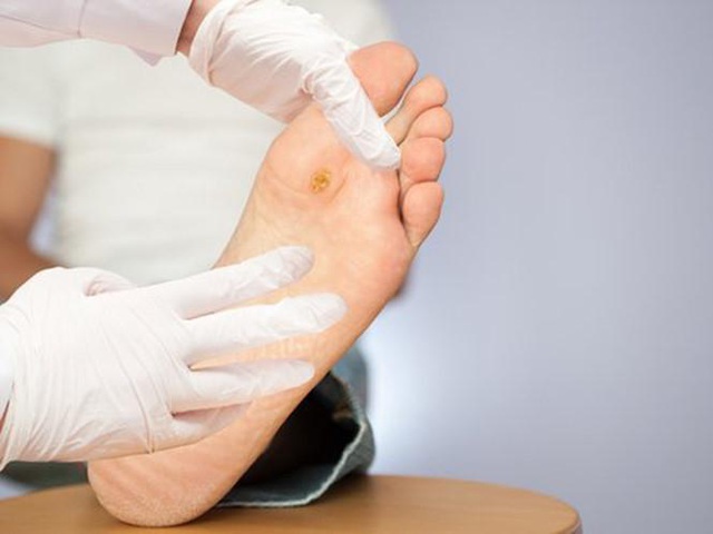 Chăm sóc bàn chân người bị tiểu đường