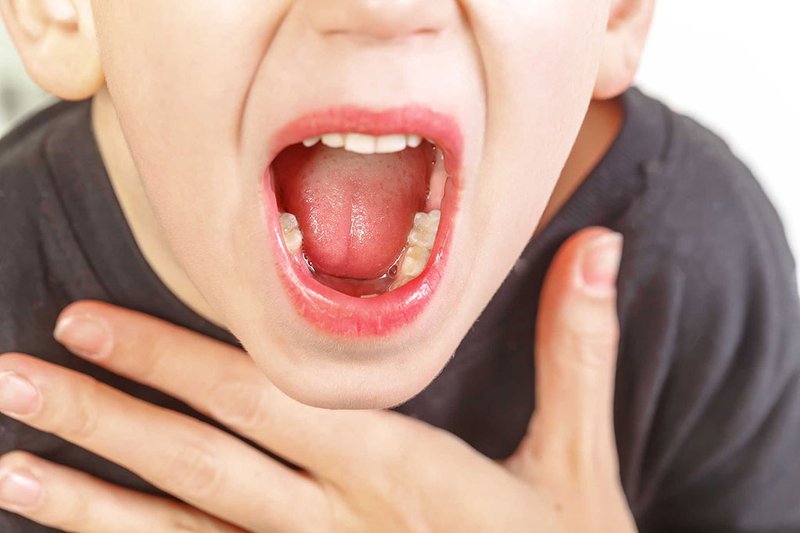 Viêm họng khi giao mùa - bệnh thường gặp, biến chứng nguy hiểm