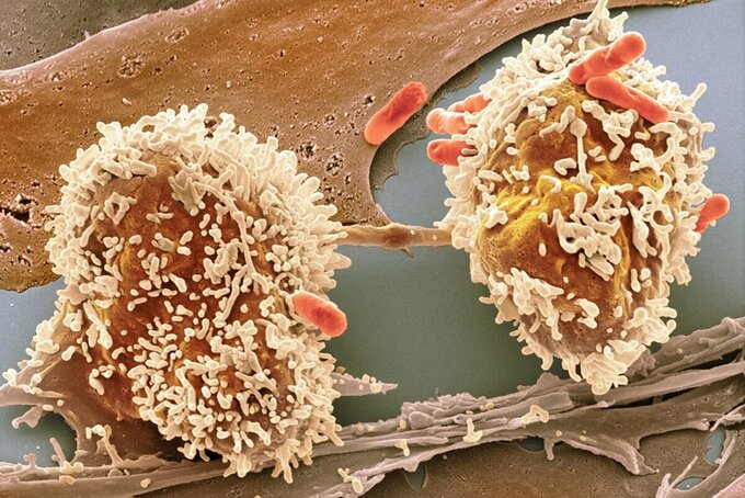 Ảnh qua kính hiển vi của một tế bào ung thư đại tràng đang phân chia. Ảnh: Science