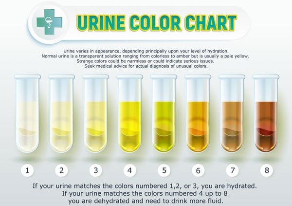 Màu của nước tiểu cảnh báo điều gì về sức khỏe của bạn?