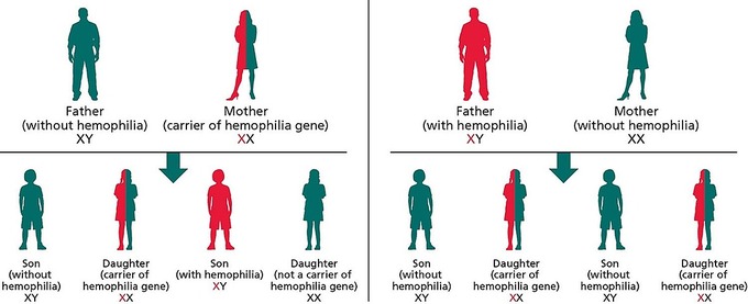 Khả năng di truyền bố không bệnh, mẹ mang gene bệnh (bên trái), và khi bố mắc bệnh, mẹ không bệnh (bên phải). Ảnh: Health Jade.