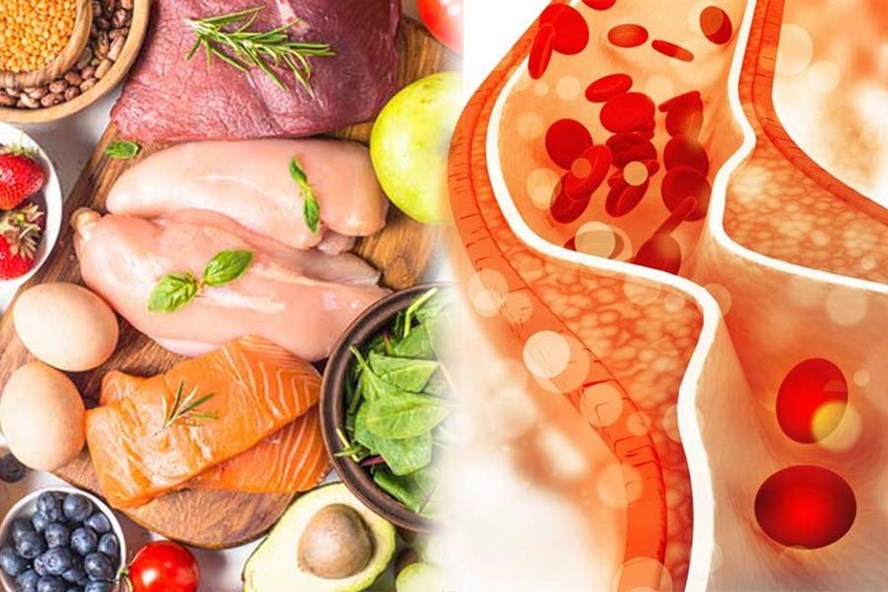 Bỏ túi danh sách những thực phẩm giàu cholesterol tốt