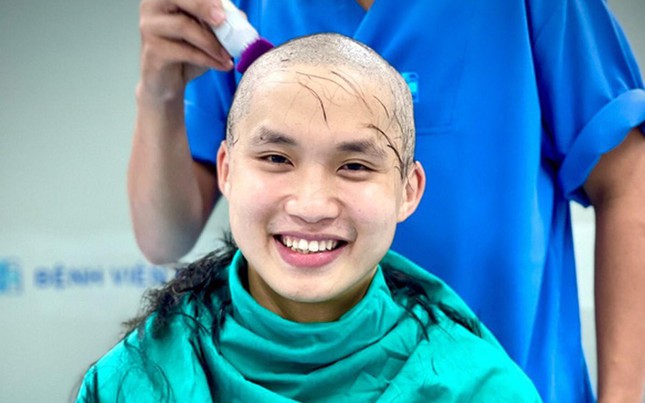 Nụ cười tỏa nắng của bác sĩ trẻ Đặng Minh Hiệu khi quyết định "xuống tóc" để đi vào tâm dịch Bắc Giang - Ảnh: Q.NG.