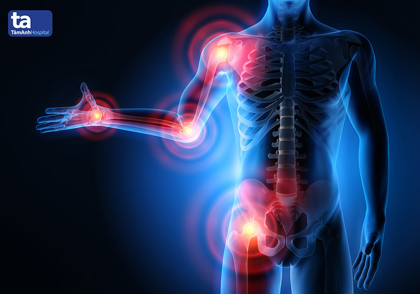 5 hành vi ảnh hưởng đến sức khỏe xương khớp người sau 50 tuổi