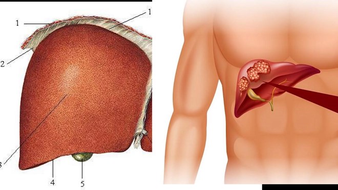 5 cách tăng tuổi thọ cho gan